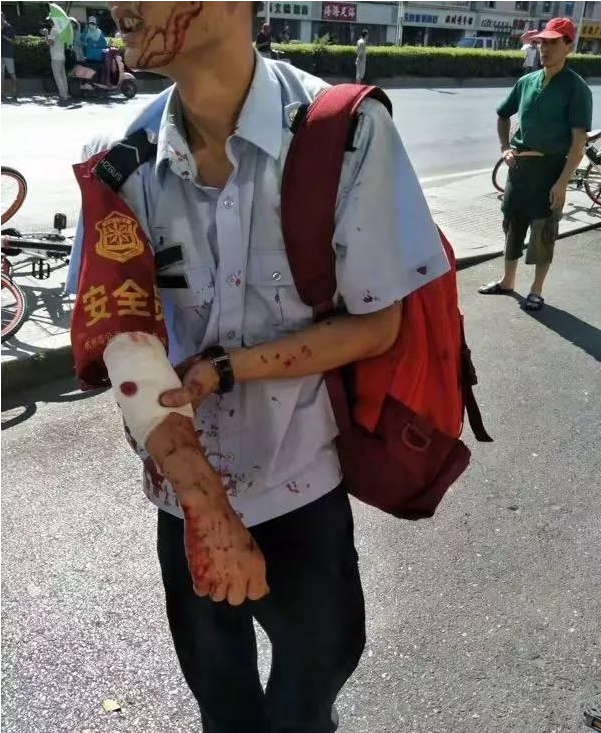 ���ݲ��^ú��ƿ��ը�º󣺏�δ���bȼ?x��)�й¶̽�y����